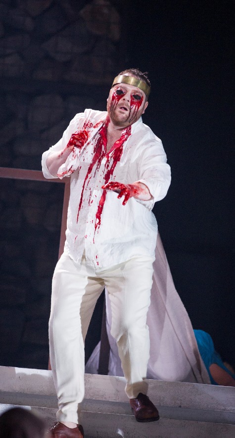 picture of Roland Wood as the self-mutilated Oedipus 